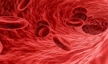 علامات أنيميا نقص الحديد وطرق علاجها وأسبابها