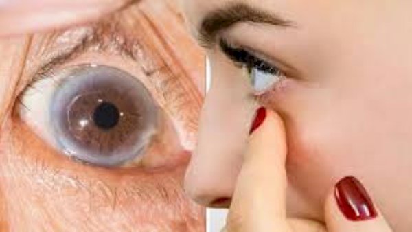 يظهر في صمت.. 6 علامات قد تكشف ارتفاع الكوليسترول في الجسم