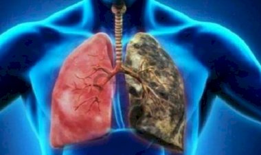 طرق الوقاية من سرطان الرئة