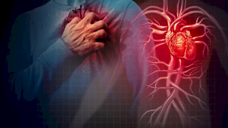 أعراض الذبحة الصدرية .. هل تسبب الوفاة؟