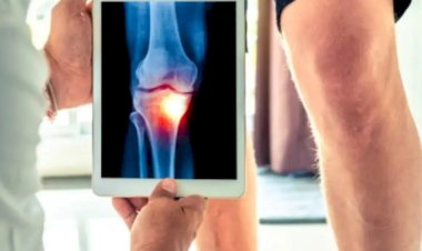 طرق بسيطة وطبيعية لتخفيف آلام الركبة طرق بسيطة وطبيعية لتخفيف آلام الركبة