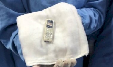 استخراج هاتف محمول من بطن مريض بعد 11 شهرا بمركز الجهاز الهضمي بالمنصورة