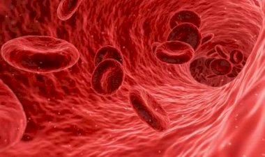 أعراض فقر الدم الأنيميا وأنواعها المختلفة.. ومتى تستشير الطبيب؟