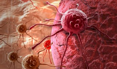 علامات وأعراض تكشف السرطان بسرعة