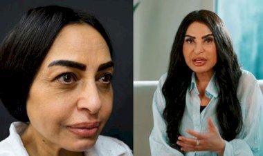 سلوى خطاب بعد عملية شد الوجه: كان عندى تكتلات دهنية فى وشى وشلتها