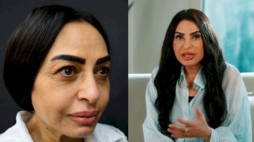 سلوى خطاب بعد عملية شد الوجه: كان عندى تكتلات دهنية فى وشى وشلتها